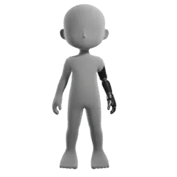 Prosthetic Arm