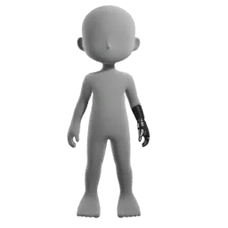 Prosthetic Forearm